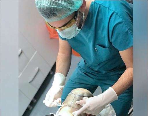 Hermest Hair Transplant Center, Turkey