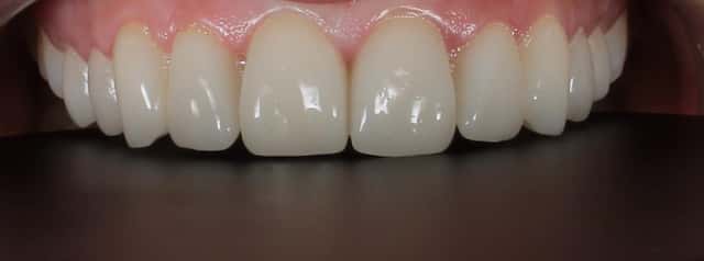 Ang Dental Solutions