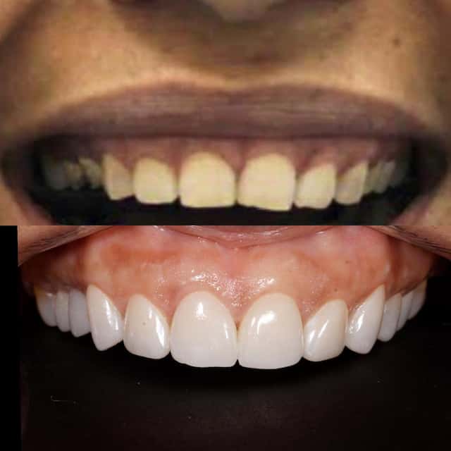 Ang Dental Solutions