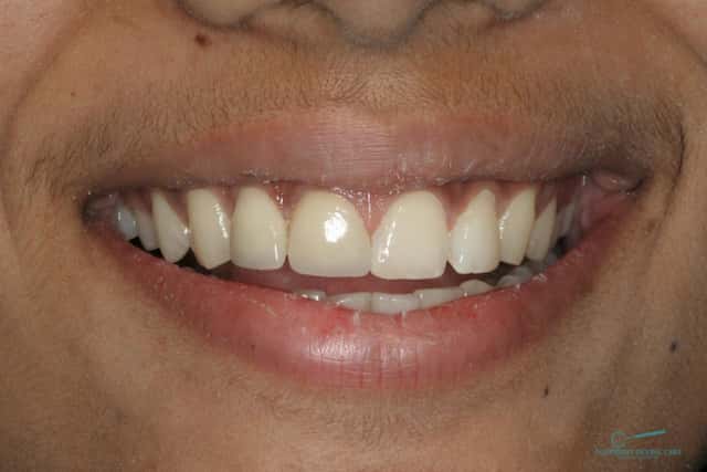 Perawatan Gigi Percaya Diri