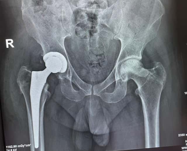 Klinik Waleus, Delhi