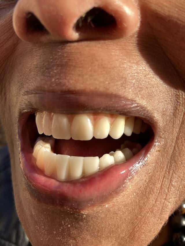 ፍጹም ፈገግታ ጥርስ - ክላርሽም