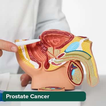 Prostate Cancer Treatment