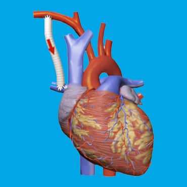 Block-TASSISGE MINUTUT (BT GINUT)