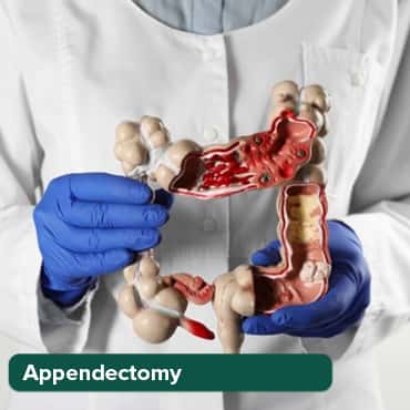 Laparoscopic Appendectomy