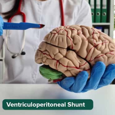 ventriculoperitoneal (VP) shunt