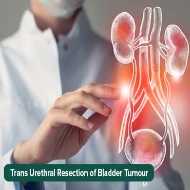 Reseksi tumor kandung kemih transurethral (TURBT))