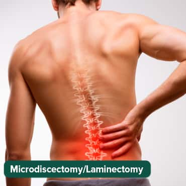 ማይክሮዲስሴክቶሚ / ላሚንቶሚ