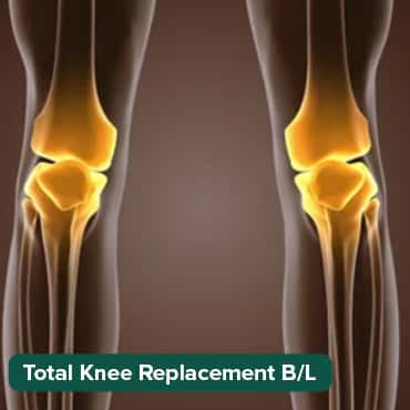 Total Knee Replacement-B/L