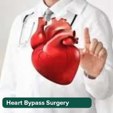 Chirurgie de greffe de pontage coronarien (CABG)