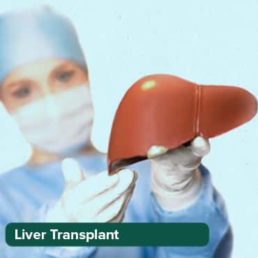 Liver Transplant