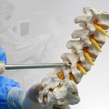 Transforaminal interbody lumbar fusion (TLIF))