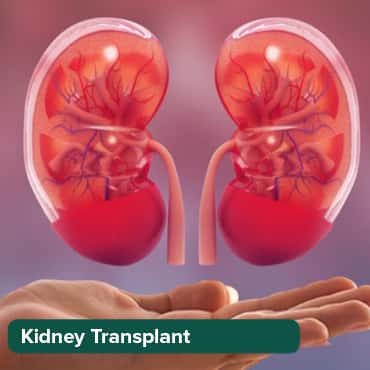 kidney transplant