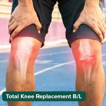 Total Knee Replacement (Bilateral)