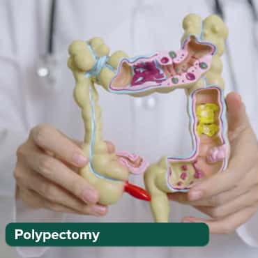 Hystroscopy & Polypectomy