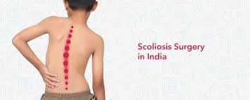Scoliosis